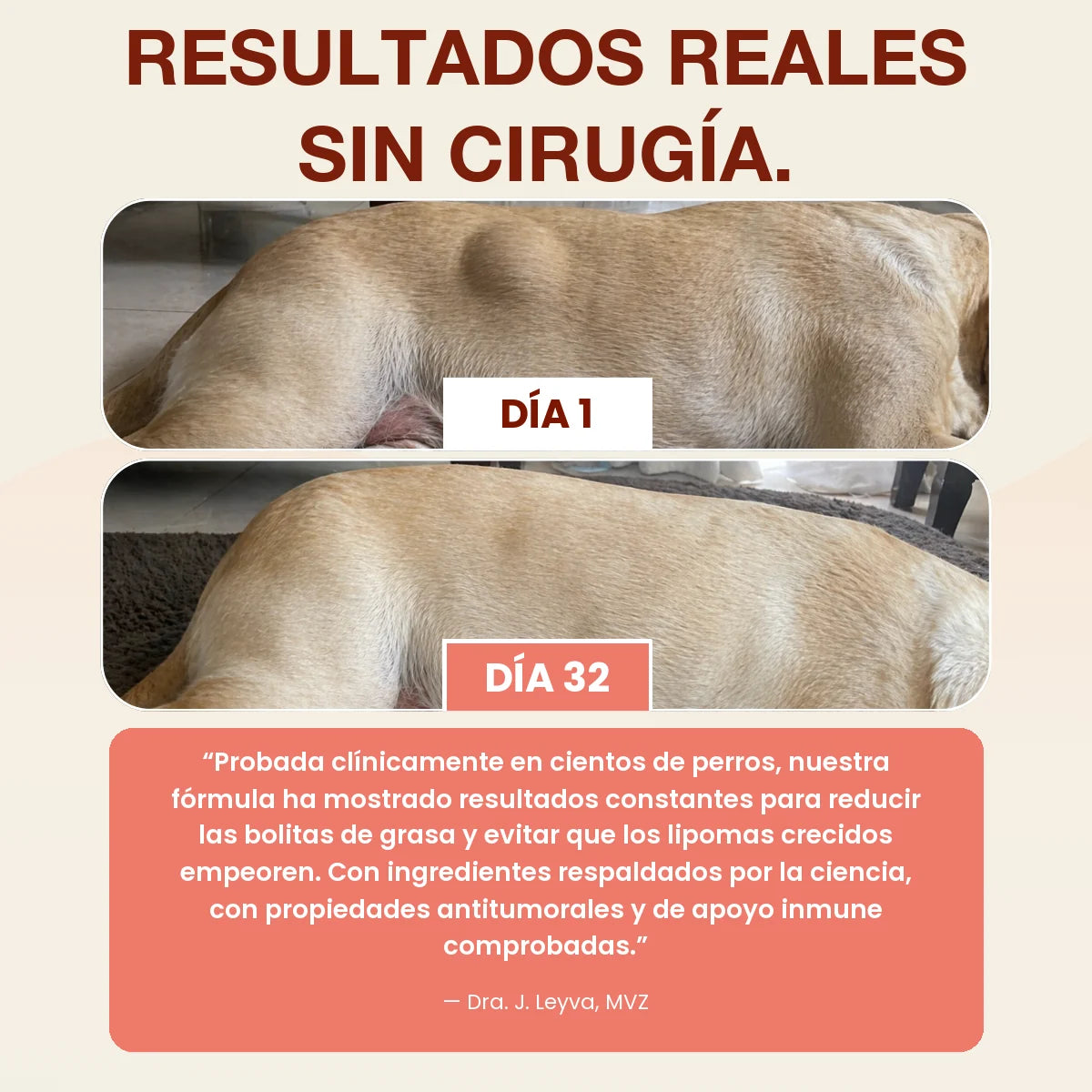 Resultados reales sin cirugía: bolita de grasa el día 1 y el día 32